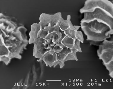 APII jpeg image of Fossombronia wattsii  © contact APII